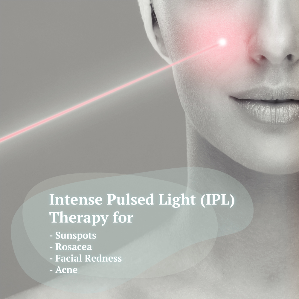 Intense Pulsed Light Adelaide